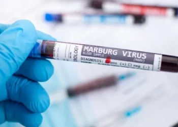 Perezida Samia Suluhu Hassan yemeje ko habonetse uburwayi bwa Marburg muri Tanzania