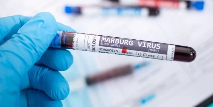 Perezida Samia Suluhu Hassan yemeje ko habonetse uburwayi bwa Marburg muri Tanzania