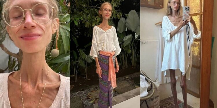 Karolina Krzyzak yitabye Imana azize kunanuka gukabije