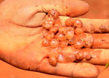 Imvura y’urubura yangije ibihingwa n’inzu i Musheri